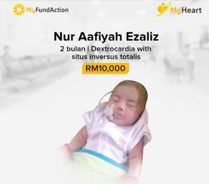 Baby Aafiyah Hilang Peti Suara, Kini Minum Susu Melalui Tiub di Hidung